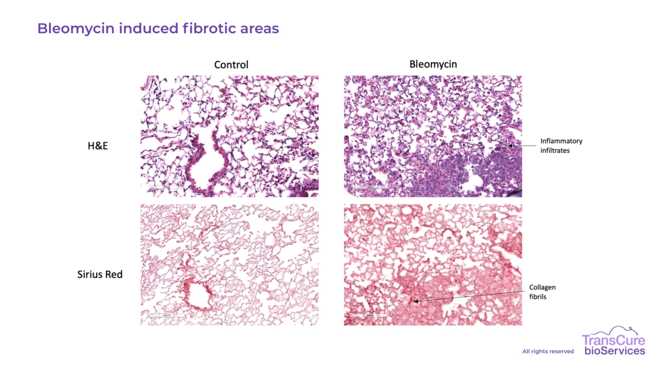 Bleomycin induced fibrotic areas